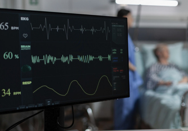 EKG sendiri merupakan prosedur pemeriksaan medis non-invasif yang cepat, aman, dan tanpa rasa sakit. Ilustrasi Freepik