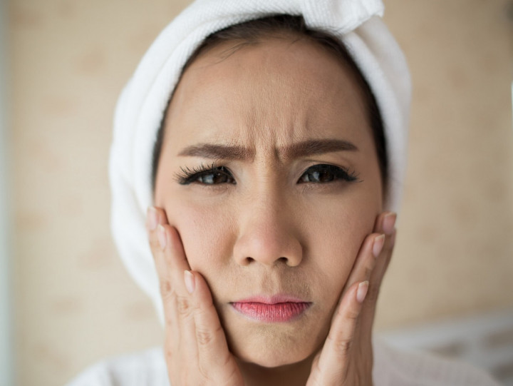 Umur 20-an Udah Muncul Garis Halus? Fix Lifestyle Kamu Perlu Dibenahi