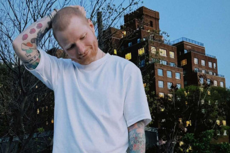 Ed Sheeran Sakit Herpes