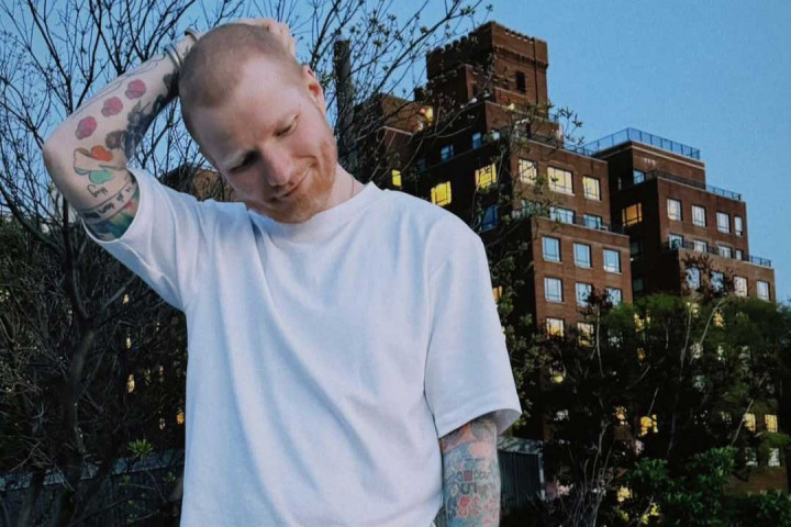 Ed Sheeran Sakit Herpes