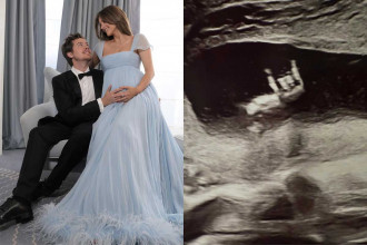 Barbara Palvin Umumkan Kehamilan Anak Pertama dengan Dylan