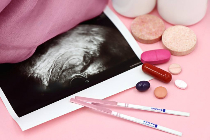 Promil Bukan Cuma Urusan Cewe! Faktor Cowok Nyumbang 30% Kasus Fertilitas