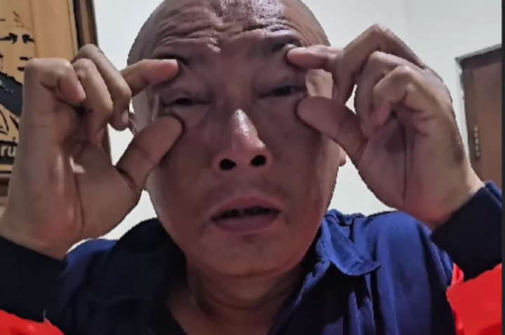 Ngilu! Host Jejak Si Gundul Kena Sembur Bisa Ular Kobra, Begini Kondisinya