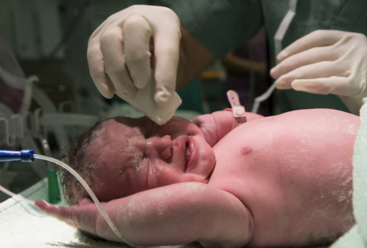 Jangan Asal Bersihin! Ini Cara Merawat Pusar Bayi Baru Lahir yang Benar