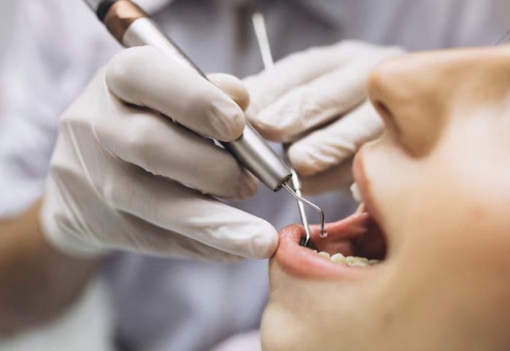 Rajin Skincare tapi Lupa ke Dokter Gigi? Ini Risiko yang Sering Diabaikan
