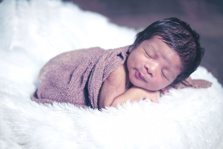 Pusar Bayi Merah & Benjol? Kenalin Granuloma Umbilikal!