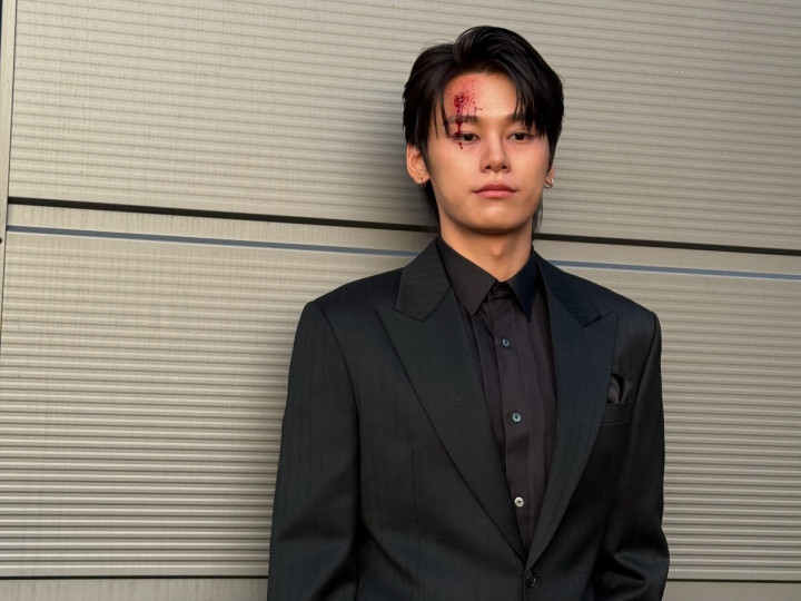 Cha Woo-min Cedera saat Syuting Drama Korea Study Group 2