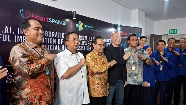 RSCM dan HeartSpan.ai Berhasil Tanamkan LVAD Terkecil Pertama di Asia
