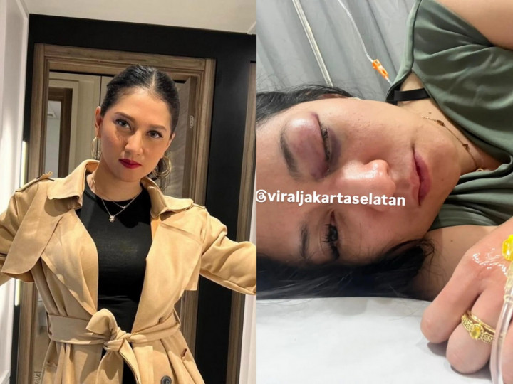 Artis Sali Irsalina Alami Penganiayaan, Langsung Lapor Polisi