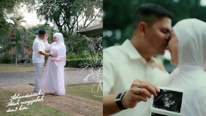 Selamat! Irish Bella Hamil Anak Pertama dari Haldy Sabri