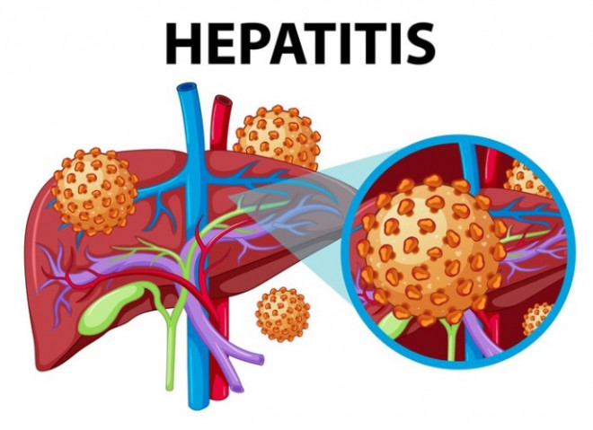 Hepatitis. DOK Magnific