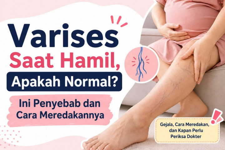 Varises saat Hamil, Apakah Normal? Ini Penyebab dan Cara Meredakannya