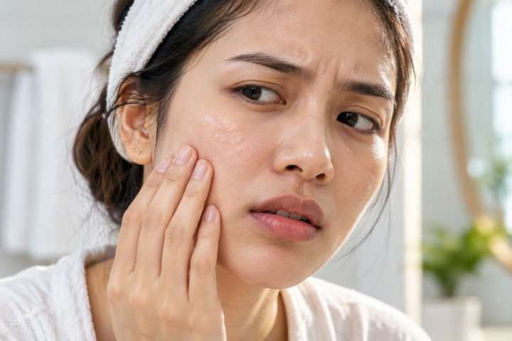 Wajah Terasa Ketarik Setelah Cuci Muka? Jangan Dianggap Sepele