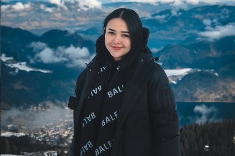 Perjuangan Amanda Manopo Melahirkan, Sempat Hadapi Kondisi Kista