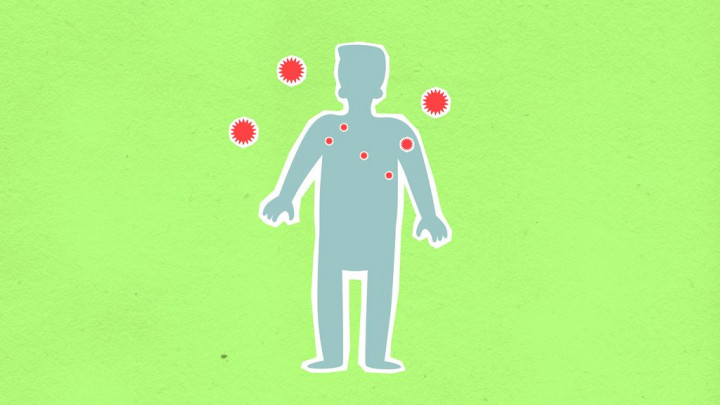 Virus Shamonda yang Biasa Ada di Sapi, Catat Kasus Pertama pada Manusia
