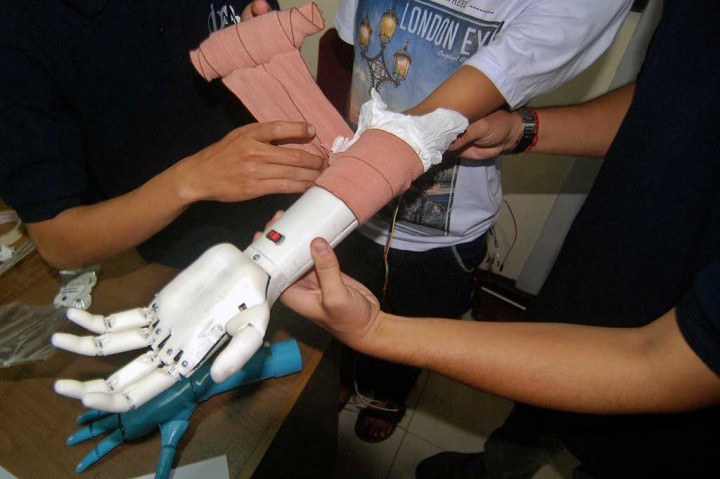 Mahasiswa Undip Ciptakan Tangan Bionik