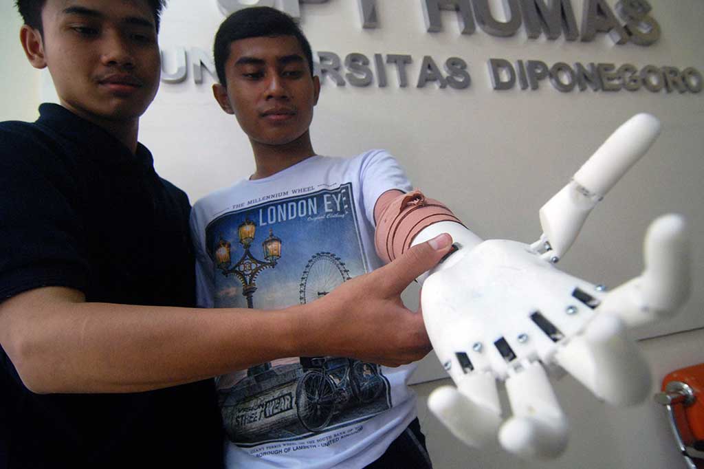 Mahasiswa Undip Ciptakan Tangan Bionik