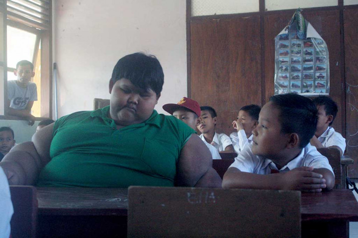 Bocah berusia 10 tahun itu semula dirawat di Rumah Sakit Hasan Sadikin Bandung sejak Senin (11/7/2016), namun memaksa pulang karena ingin sekolah pada hari pertama masuk di tahun ajaran baru 2016/2017.