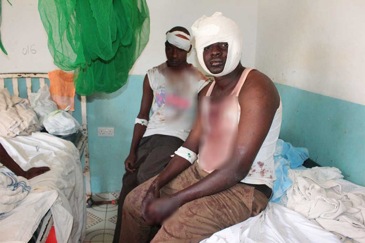 Korban luka-luka mendapat perawatan di rumah sakit.