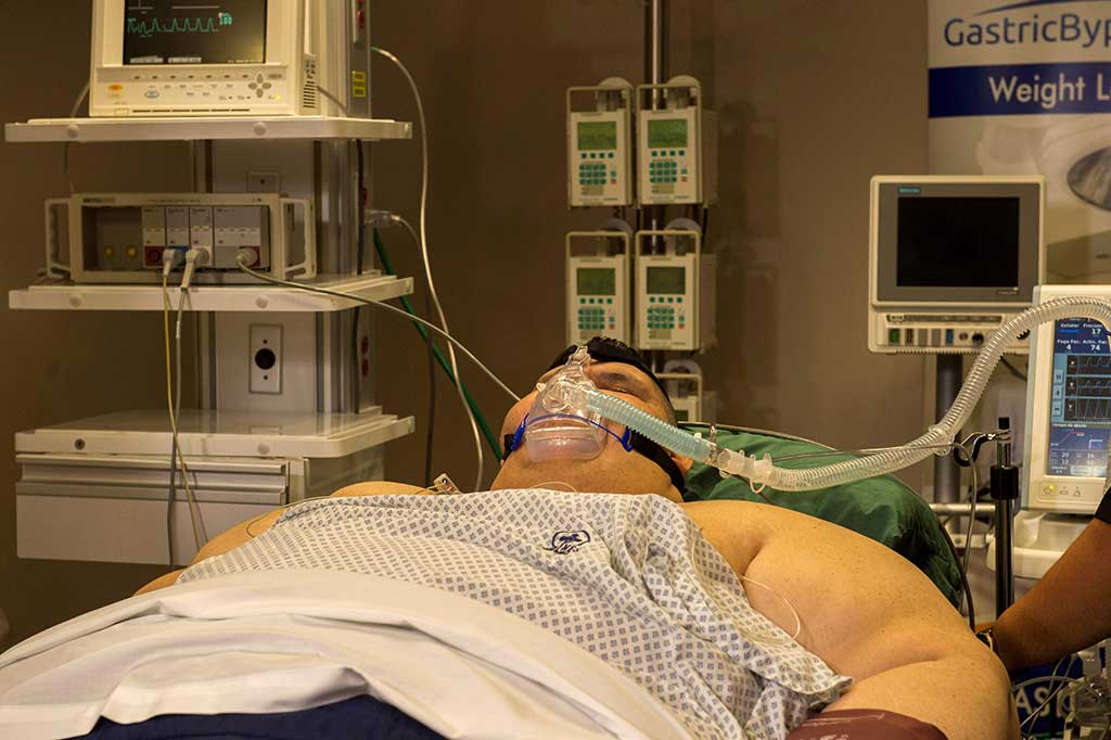 Franco (32) menjalani diet selama tiga bulan untuk mempersiapkan diri sebelum operasi. Selama diet dia berhasil mengurangi 175 kilogram berat badannya.