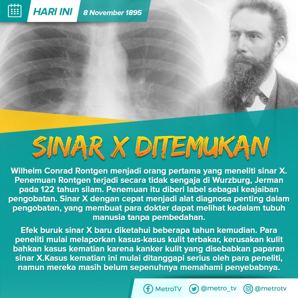 Hari Ini: Sinar X Ditemukan