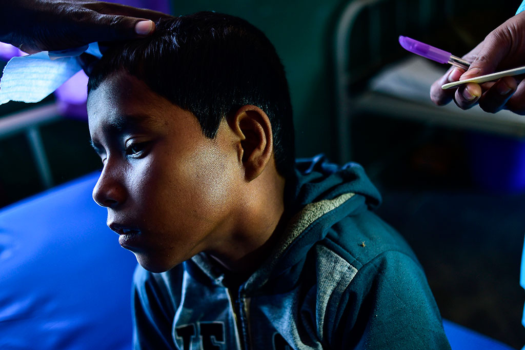 Mengingkat area yang digunakan sejumlah pengungsi lebih kecil dan sedikitnya sanitasi atau perawatan kesehatan, keberadaan mereka menjadi lahan subur untuk penyakit pernapasan yang sangat menular tersebut.