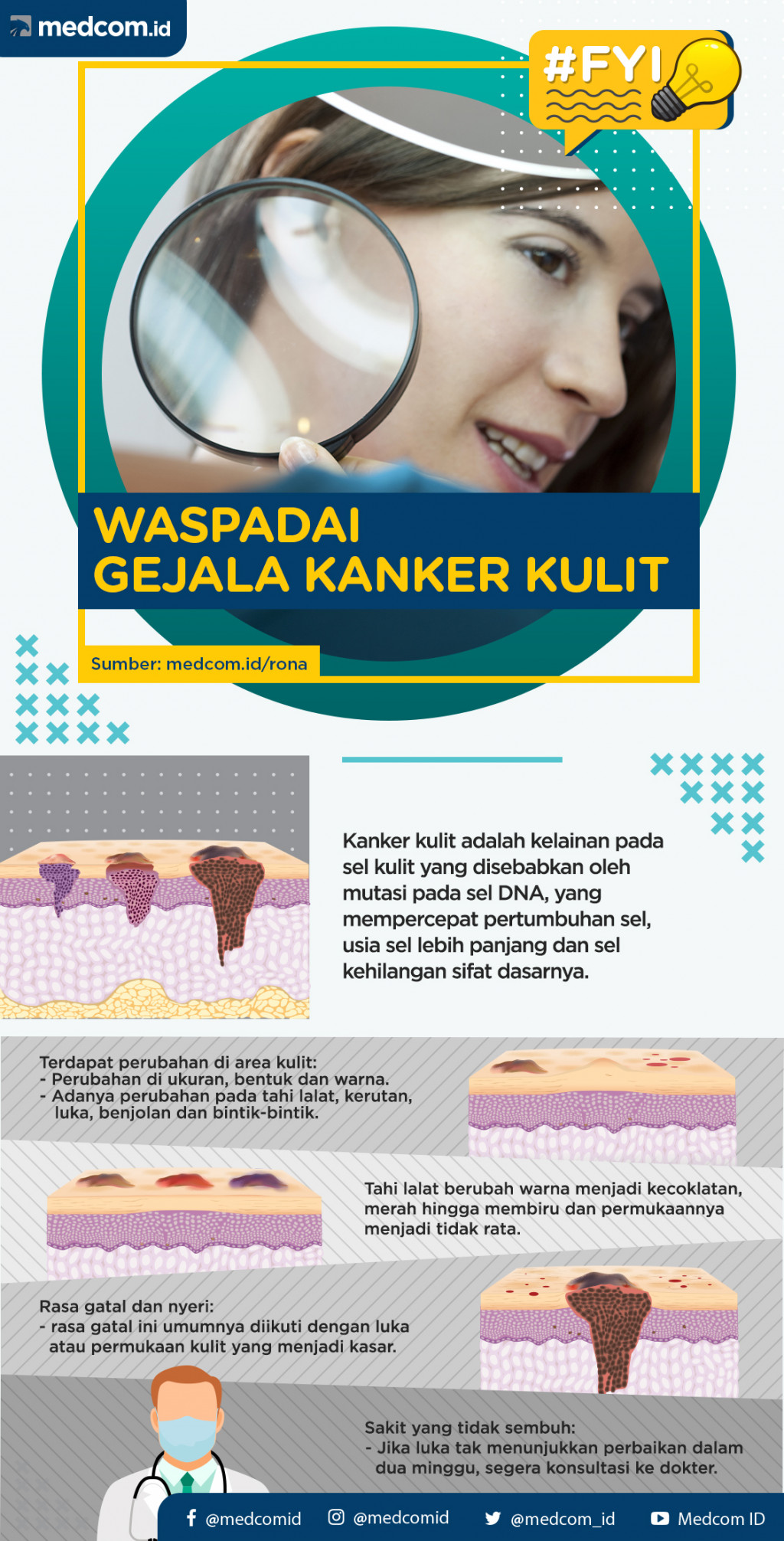 FYI: Waspadai  Gejala Kanker Kulit