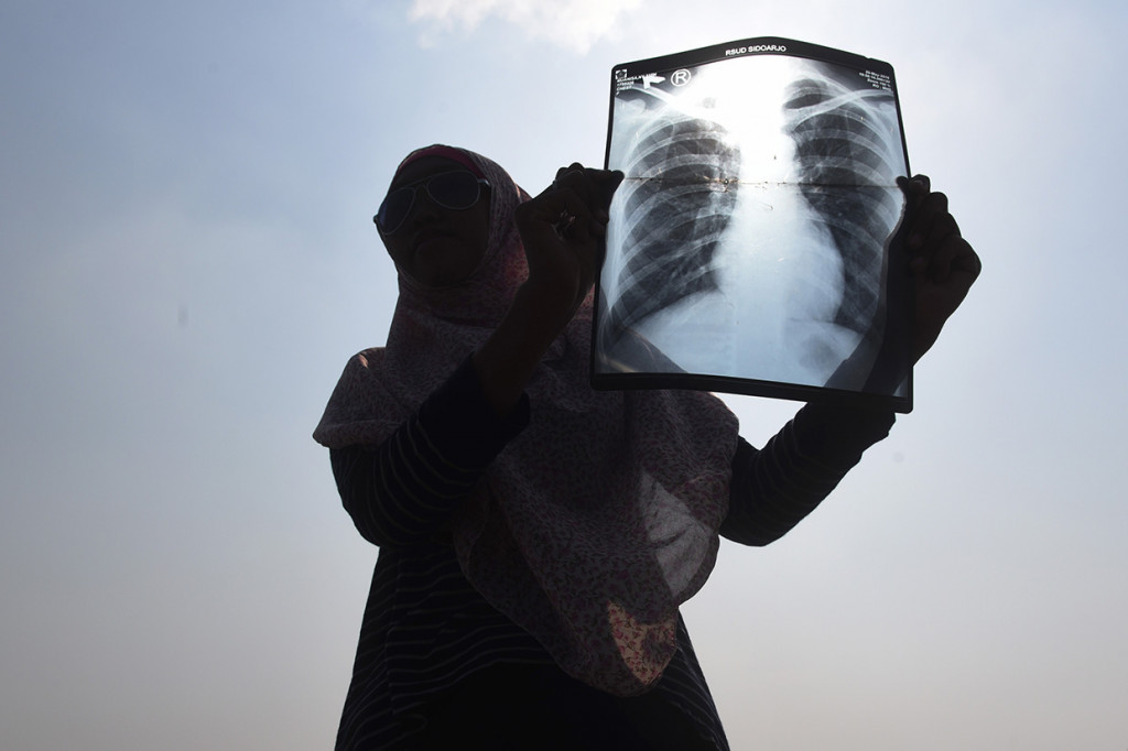 Seorang warga korban lumpur Lapindo menunjukan foto hasil rontgen di titik 25 tanggul penahan lumpur Lapindo saat aksi memperingati 12 tahun semburan lumpur Lapindo di Porong, Sidoarjo, Jawa Timur. 
