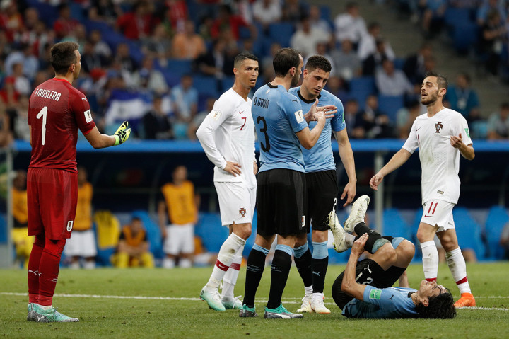 Petaka bagi Uruguay di menit ke-70, ketika Cavani berjalan terpincang-pincang dan memberi isyarat minta diganti. Afp Photo/Adrian Dennis