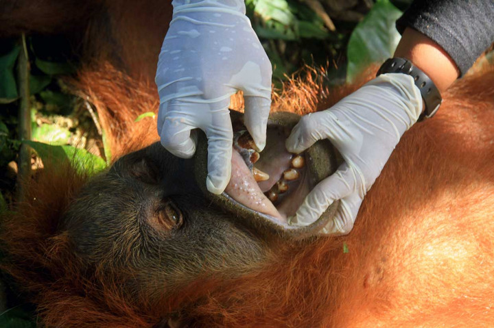Seekor orang utan sumatra (Pongo abelii) diperiksa saat dilakukan proses evakuasi oleh petugas Yayasan Ekosistem Lestari-Sumatran Orangutan Conservation Programme (YEL-SOCP) dan BKSDA Aceh di  Desa Geulagang Gajah, Kuala Bate, Aceh Barat Daya, Aceh, Jumat, 3 Agustus 2018.
