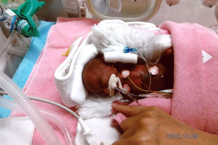 Ryusuke Sekiya dilahirkan melalui operasi caesar darurat saat usia kandungan 24 minggu lima hari karena ibunya Toshiko mengalami hipertensi. Bayi tersebut lahir dengan berat hanya 258 gram, tidak lebih berat dari sebuah apel dan panjang 22 centimeter.