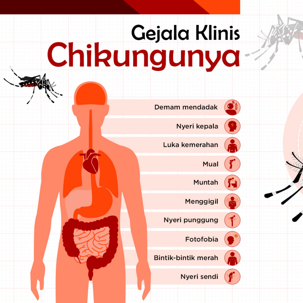 Gejala Klinis Chikungunya