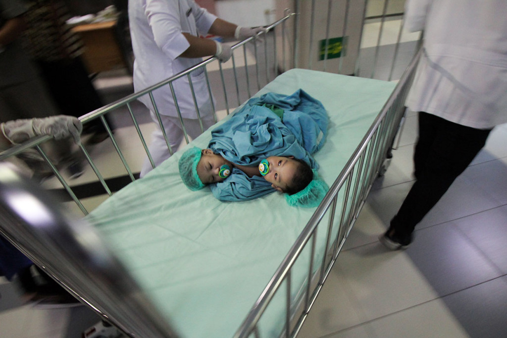 Operasi Aqila dan Azila ini merupakan operasi pemisahan bayi kembar siam yang ke-99 bagi tim RSUD dr Soetomo.