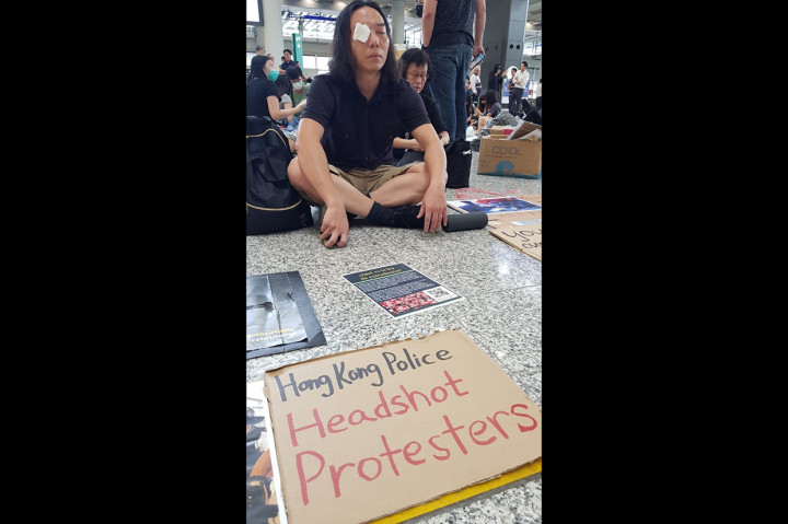 Sejumlah pengujuk rasa menggunakan bandana untuk menutup mata mereka sebagai ungkapan protes setelah muncul gambar seorang wanita berdarah di matanya pada Minggu, 11 Agustus 2019. Perempuan itu dilaporkan terkena tembak proyektil polisi.
