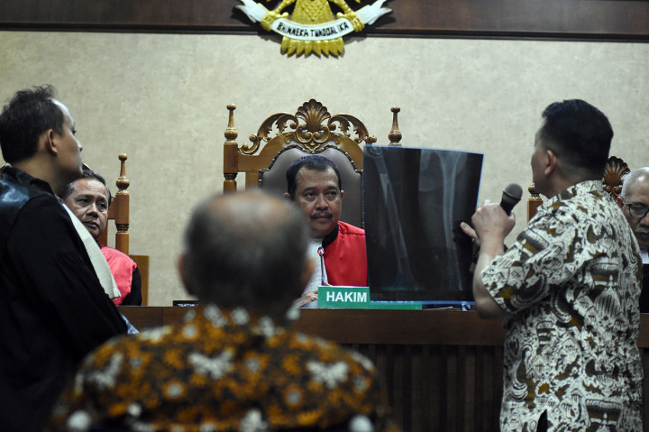 Dokter dari terdakwa kasus dugaan kepemilikan senjata api ilegal Kivlan Zen menunjukkan hasil rontgen kliennya saat sidang pembacaan eksepsi di Pengadilan Negeri Jakarta Pusat. Antara Foto/Indrianto Eko Suwarso