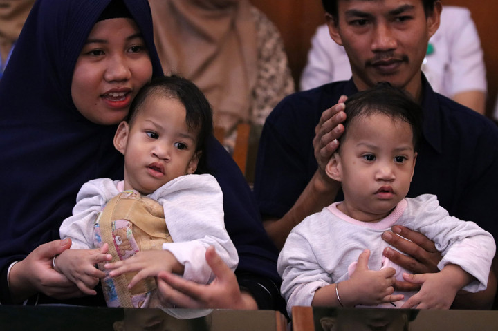 Bayi kembar siam yang telah berhasil dipisahkan dengan operasi pada Rabu, 14 Agustus 2019 itu, hari ini diperbolehkan pulang ke Kendari setelah tim penanganan dari RSUD Dr Soetomo menyatakan kondisi kesehatan dan fisiknya semakin membaik.