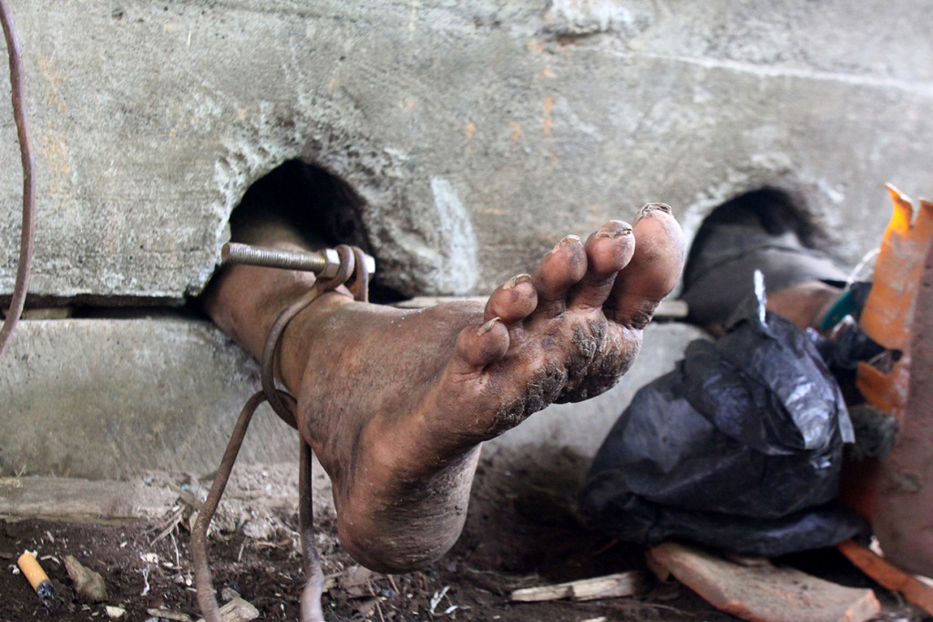 Orang Dengan Gangguan Jiwa (ODGJ) berinisial SY berada dalam pasungan beton selama empat tahun sebelum di evakuasi di Dampit, Malang, Jawa Timur.
