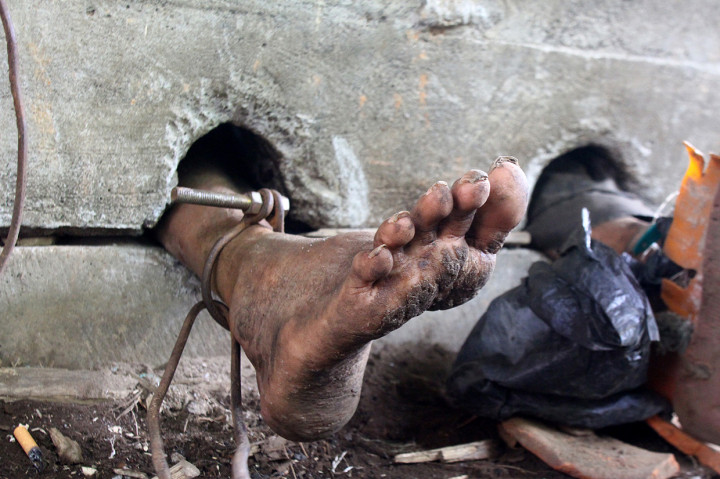 Orang Dengan Gangguan Jiwa (ODGJ) berinisial SY berada dalam pasungan beton selama empat tahun sebelum di evakuasi di Dampit, Malang, Jawa Timur.
