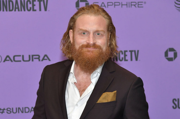 Sementara itu, aktor Kristofer Hivju yang terkenal setelah memerankan Tormund yang tangguh dan berjanggut dalam film 'Game of Thrones', juga positif terinfeksi virus korona.