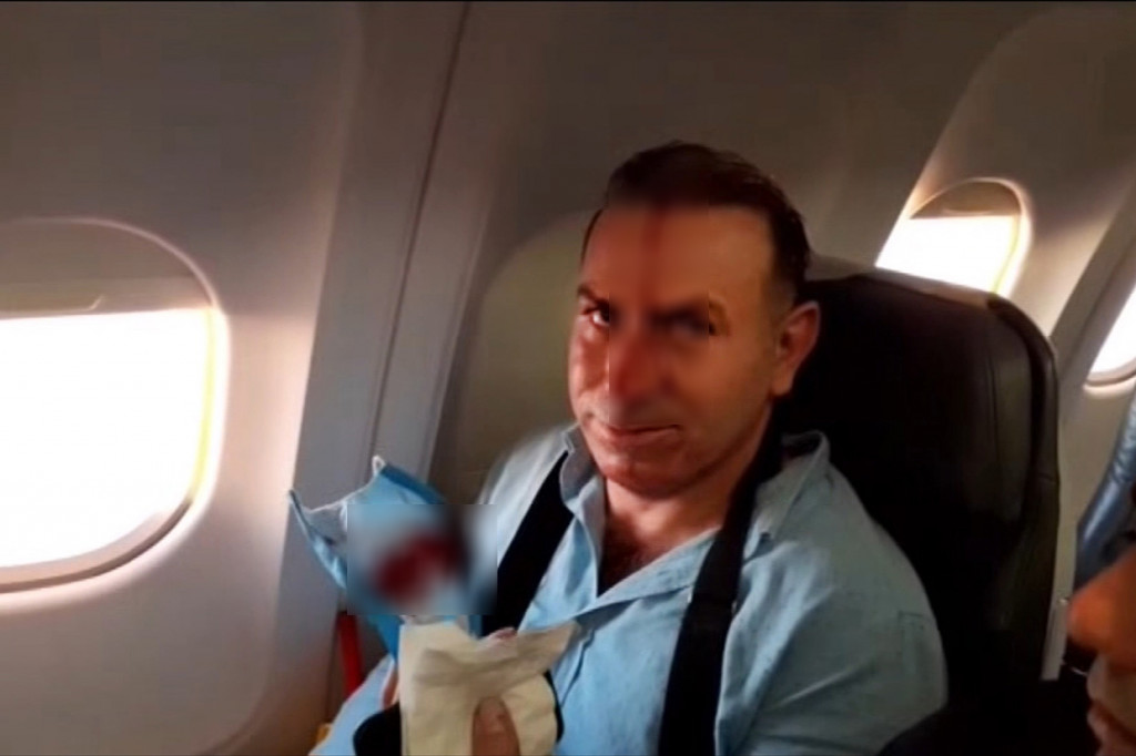 Sementara gambar lain memperlihatkan seorang pria terluka di wajahnya. Mahan Air kemudian melanjutkan penerbangan menuju Beirut, Libanon dengan selamat.