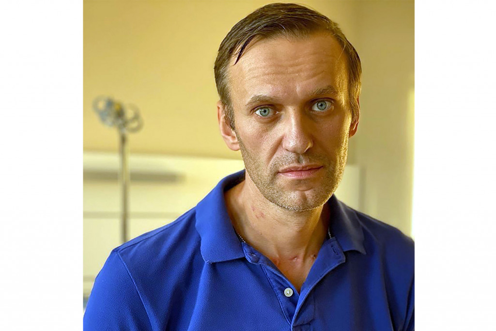 Menurut pengakuan Navalny, dirinya sulit mengenali wajah orang atau berbicara di hari pertama perawatannya di RS Charite.