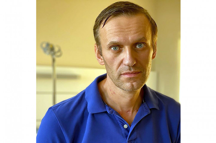 Menurut pengakuan Navalny, dirinya sulit mengenali wajah orang atau berbicara di hari pertama perawatannya di RS Charite.