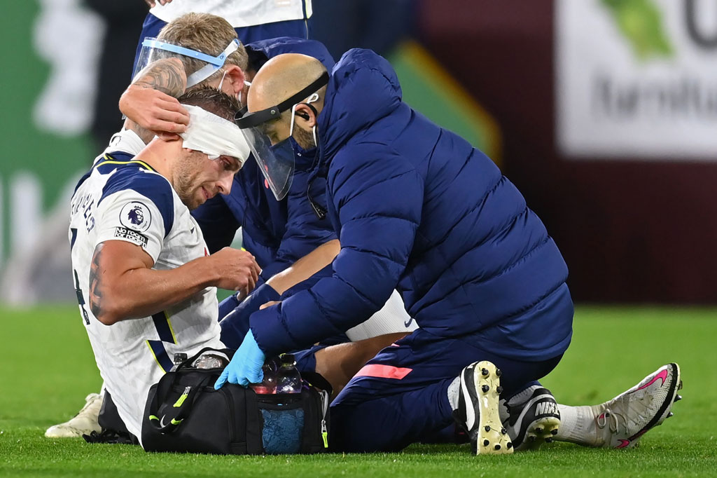 Laga sempat dihentikan setelah Alderweireld harus mendapatkan perawatan karena alis kanannya berdarah setelah secara tidak sengaja terkena siku Ashley Barnes saat berebut bola di udara. Kepala pemain timnas Belgia tersebut kemudian dibalut sebelum permainan dilanjutkan.