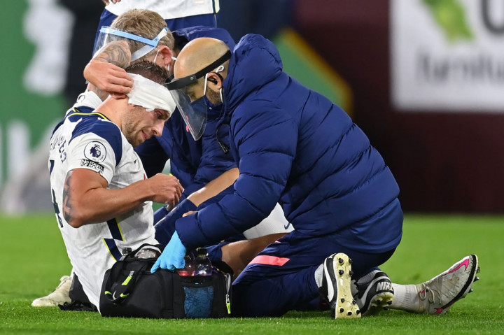 Laga sempat dihentikan setelah Alderweireld harus mendapatkan perawatan karena alis kanannya berdarah setelah secara tidak sengaja terkena siku Ashley Barnes saat berebut bola di udara. Kepala pemain timnas Belgia tersebut kemudian dibalut sebelum permainan dilanjutkan.