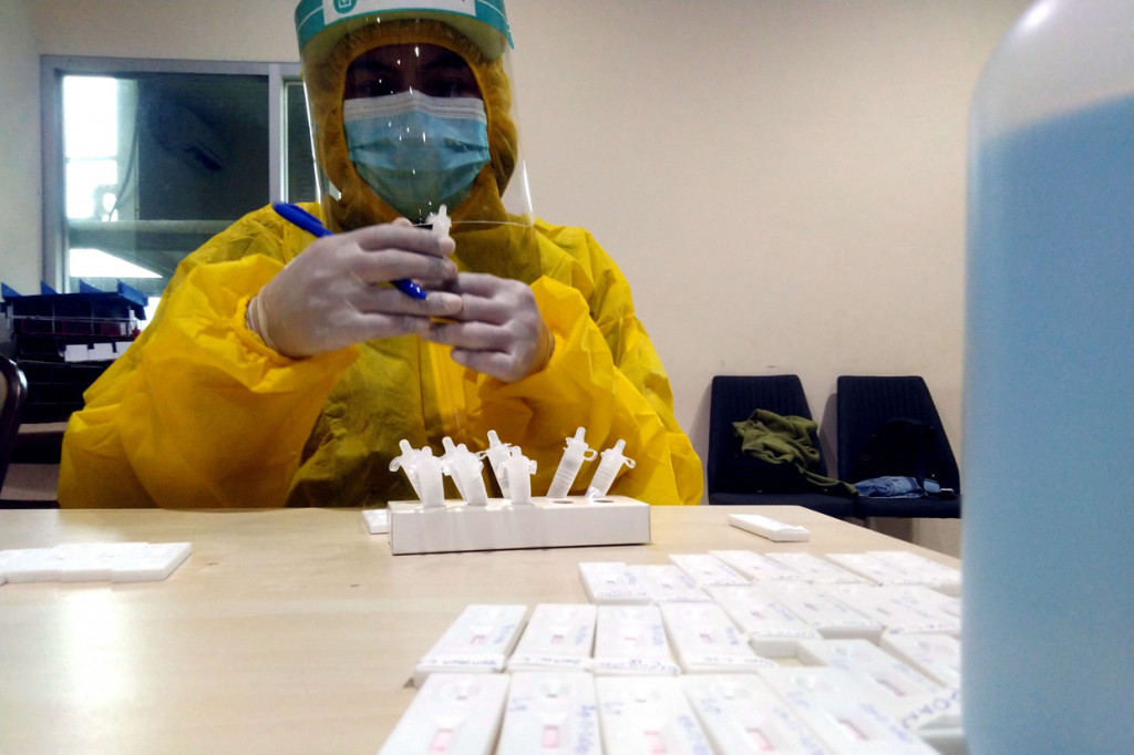 Tak berapa lama kemudian, hasil Rapid Test Antigen sudah dapat diketahui masing-masing wartawan yang semuanya menunjukkan hasil negatif dari Covid-19.