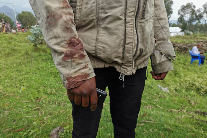 Seorang pria yang mencoba membantu pengemudi yang terluka dari Duta Besar Italia untuk DRCOngo Luca Attanasio mengenakan jaket bernoda darah.