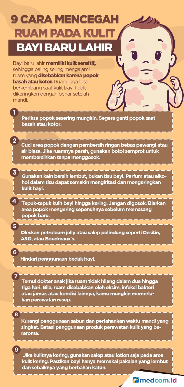 9 Cara Mencegah Ruam pada Kulit Bayi Baru Lahir