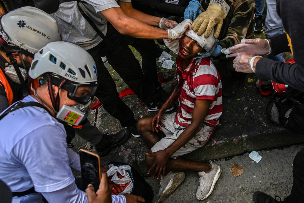 Seorang pria terluka dalam bentrokan dengan polisi antihuru-hara dibantu oleh paramedis selama protes terhadap pemerintah di Medellin, Kolombia.