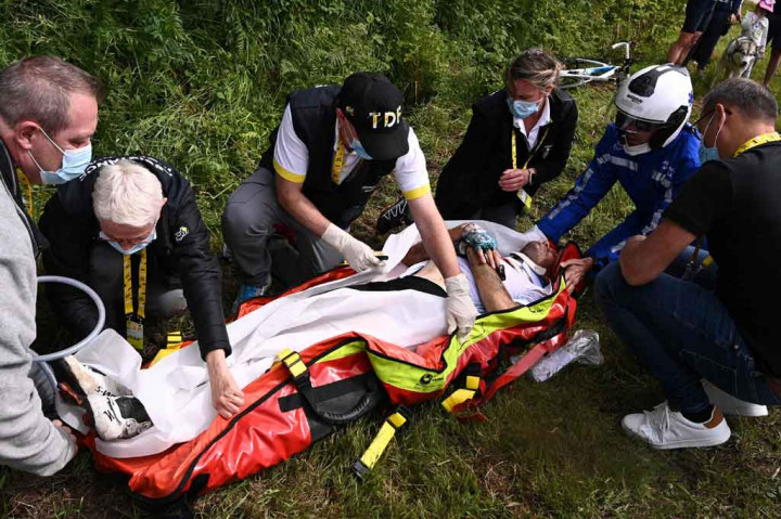 Lusinan pembalap mengalami luka dan memar serta satu dengan tangan patah, memicu perdebatan tentang keselamatan dan perilaku penonton di Tour de France, di mana para penggemar diizinkan untuk berbaris di jalan.
