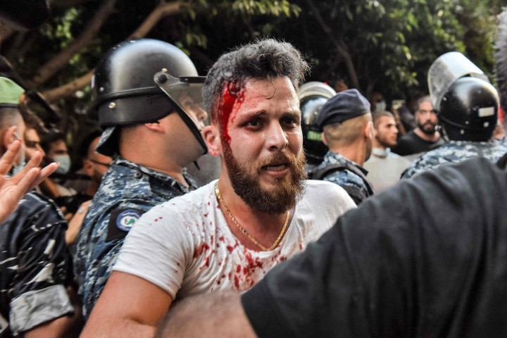 Sejumlah orang terluka dalam bentrokan ini. 